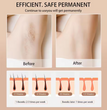 Digital IPL Hair Removal Device TrendyZone